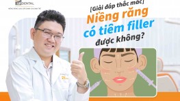 Niềng răng có tiêm filler được không? [Giải đáp]