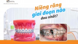 Niềng răng giai đoạn nào đau nhất?