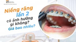 Niềng răng lần 2 có ảnh hưởng gì không? Giá bao nhiêu?