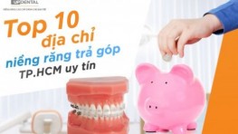 Top 10 địa chỉ niềng răng trả góp TP.HCM uy tín