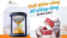 Thời điểm vàng để niềng răng là khi nào? [Giải đáp]