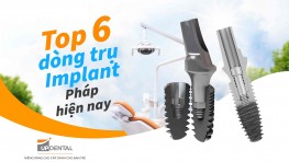 Top 6 dòng trụ Implant Pháp được sử dụng nhiều hiện nay