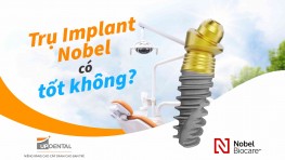 Trụ Implant Nobel (Thụy Điển) - Chi phí và ưu điểm