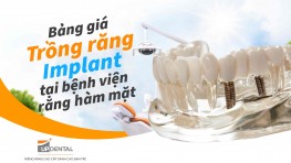 Bảng giá trồng răng Implant tại bệnh viện răng hàm mặt