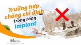 Trường hợp chống chỉ định trồng răng Implant