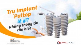 Trụ Implant Paltop (Mỹ) - Chi phí và ưu điểm