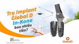 Trụ Implant Global D In-Kone (Pháp) - Chi phí và ưu điểm 