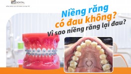 Niềng răng có đau không? Vì sao niềng răng lại đau? 