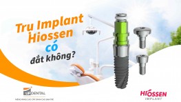 Trụ Implant Hiossen có đắt không? - Những thông tin cần biết