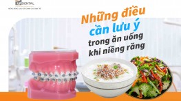 Những điều cần lưu ý trong ăn uống khi niềng răng