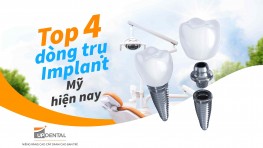 Top 4 dòng trụ Implant Mỹ hiện nay 