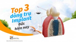 Top 3 dòng trụ Implant Đức hiện nay