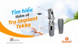 Trụ Implant Tekka (Pháp) - Chi phí và ưu điểm