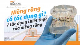 Niềng răng có tác dụng gì? 7 tác dụng thiết thực của niềng răng