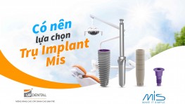 Có nên lựa chọn Trụ Implant Mis?