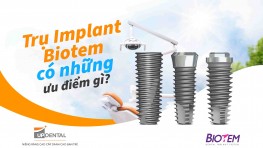 Trụ Implant Biotem giá bao nhiêu và có những ưu điểm gì?