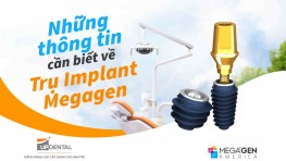 Những thông tin cần biết về Trụ Implant Megagen