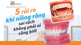 5 rủi ro khi niềng răng sai cách không phải ai cũng biết