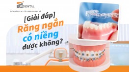 [Giải đáp thắc mắc] Răng ngắn có niềng được không?