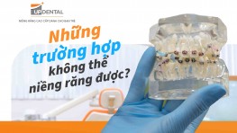 Những trường hợp không thể niềng răng được?