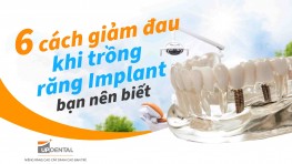 6 cách giảm đau khi trồng răng Implant bạn nên biết