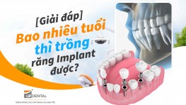 [Giải đáp] Bao nhiêu tuổi thì trồng răng Implant được?