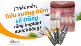 [Thắc mắc] Tiêu xương hàm có trồng răng Implant được không?