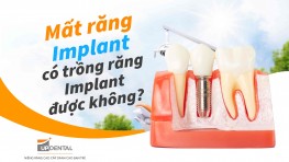 Mất răng Implant có trồng răng Implant được không?