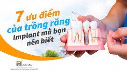 7 ưu điểm của trồng răng Implant mà bạn nên biết