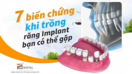 7 biến chứng khi trồng răng Implant bạn có thể gặp