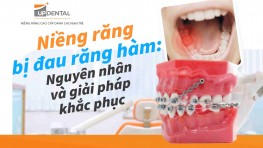 Niềng răng bị đau răng hàm: Nguyên nhân và cách khắc phục