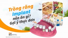 Trồng răng Implant nên ăn gì? Gợi ý thực đơn cho người mới trồng răng Implant