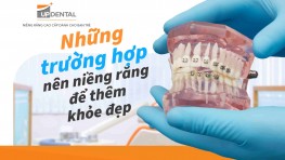 Những trường hợp nên niềng răng để thêm khỏe đẹp