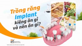 Trồng răng Implant kiêng ăn gì và nên ăn gì?