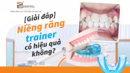 [Giải đáp] Niềng răng trainer có hiệu quả không?