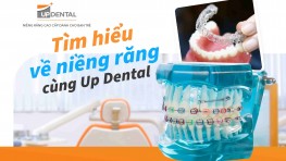 Tìm hiểu về niềng răng cùng Up Dental