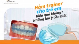 [Giải đáp] Hàm trainer cho trẻ em có hiệu quả không?