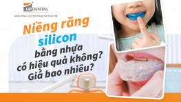 Niềng răng silicon có hiệu quả không? Giá bao nhiêu?