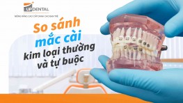 So sánh mắc cài kim loại thường và tự buộc