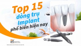 Top 15+ dòng trụ Implant phổ biến hiện nay