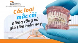 Cập nhật các loại mắc cài niềng răng và giá tiền hiện nay