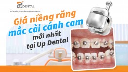 Giá niềng răng mắc cài cánh cam mới nhất tại Up Dental