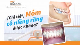 [Chi tiết] - Móm có niềng răng được không? 