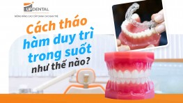 [Chi tiết] - Cách tháo hàm duy trì trong suốt như thế nào?