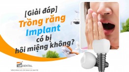 [Giải đáp] - Trồng răng Implant có bị hôi miệng không?