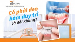 [Giải đáp] Có phải đeo hàm duy trì cả đời không?