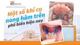 [Cập nhật] - Một số khí cụ nong hàm trên phổ biến hiện nay 