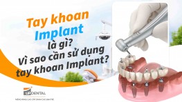 Tay khoan Implant là gì? Vì sao cần sử dụng tay khoan Implant?