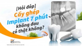 [Hỏi đáp] Cấy ghép Implant 7 phút không đau có thật không?