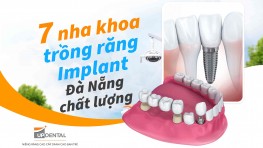 7 nha khoa trồng răng Implant Đà Nẵng chất lượng